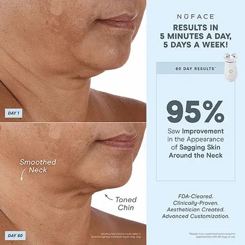 Image 1, DAY 1 Smoothed Neck DAY 60 Toned Chin NUFACE RESULTS IN 5 MINUTES A DAY, 5 DAYS A WEEK! 60 DAY RESULTS 95% Saw Improvement in the Appearance of Sagging Skin Around the Neck FDA-Cleared. Clinically-Proven. Aesthetician Created. Advanced Customization. Image 2, NUFACE 1 DEVICE 3 ATTACHMENTS ENDLESS TREATMENTS BUILT-IN SKIN SENSOR Ensures consistent microcurrent intensity for all skin types BOOST BUTTON For +25% microcurrent power SMART DEVICE 000 TECHNOLOGY Perfect For: Advanced NOFACE Customization FDA-Cleared. Clinically-Proven. Aesthetician Created. EFFECTIVE LIP 8 EYE ATTACHMENT Lifts & tightens hard-to-reach areas around mouth & eyes ENERGIZING HUM Gentle vibration when device is turned on 3 INTENSITY LEVELS UNLOCK EXCLUSIVE TREATMENTS BLUETOOTH ENABLED PAIR WITH THE NUFACE SMART APP + Image 3, LIFT THE BROW LIFT LIPS AND SMILE LINES TARGETED RESULTS NUFACE TIGHTEN SKIN AROUND THE EYES Image 4, DAY 1 NUFACE RESULTS IN 5 MINUTES A DAY, 5 DAYS A WEEK! 60 DAY RESULTS Lifted Brow 80% Saw a Lifted Brow + Awakened Eye DAY 60 FDA-Cleared. Clinically-Proven. Aesthetician Created. Advanced Customization. soport consu Image 5, DAY 1 Reduced Smile Line DAY 60 NUFACE RESULTS IN 5 MINUTES A DAY, 5 DAYS A WEEK! 60 DAY RESULTS 78% Saw an Improvement in Smile Lines FDA-Cleared. Clinically-Proven. Aesthetician Created. Advanced Customization. Image 6, NUFACE 1 DEVICE, ENDLESS CUSTOMIZABLE RESULTS INSTANT RESULTS THAT BUILD WITH CONSISTENT USE Contour Cheeks Lift® Eyes & Brows Tone Jowls & Jawline Smooth Neck & Forehead Lift® Lips & Smile Lines NOFACE "with Effective Lip & Eye Ahmet Image 7, NUFACE RESULTS IN 5 MINUTES A DAY, 5 DAYS A WEEK! 60 DAY RESULTS DAY 1 Reduced Deep Lines 93% Saw Reduction in the Appearance of Deep Lines DAY 60 FDA-Cleared. Clinically-Proven. Aesthetician Created. Advanced Customization. Image 8, NUFACE UNLOCK APP EXCLUSIVE TREATMENTS to target different layers of skin & muscles Help Reduce Wrinkles & Plump Skin Skin-Tightening Mode epidermis dermis Helps Instantly Lift & Contour Instant-Lift Mode Long-Term Muscle Sculpting" Pro-Toning Mode hypodermis muscle 000 + "WM of Un "of Unocked with NAACE A Image 9, 11:22 Advanced 15-Minute Facial-Lift S-Minute Facial-Lift® High Brow A Settings NUFACE SMART APP FOLLOW STEP-BY-STEP TUTORIALS TRACK PROGRESS CUSTOMIZE RESULTS WITH APP-EXCLUSIVE TREATMENTS SET TREATMENT REMINDERS Image 10, NUFACE TRINITY+ MINI+ FIX® Advanced Customization On-The-Go Lifting Instant Finisher UNLOCK APP-EXCLUSIVE TREATMENTS BOOST WITH +25% MICROCURRENT NuFACE SMART APP ATTACHMENT OPTIONS Eye and Lip Attachment and LED Red Light Attachment sold separately MICROCURRENT TREATMENT AREAS Jowls and Jawline Neck Cheeks & Forehead Around Eyes & Brow Around Mouth & Lips Smile Lines ✓ >