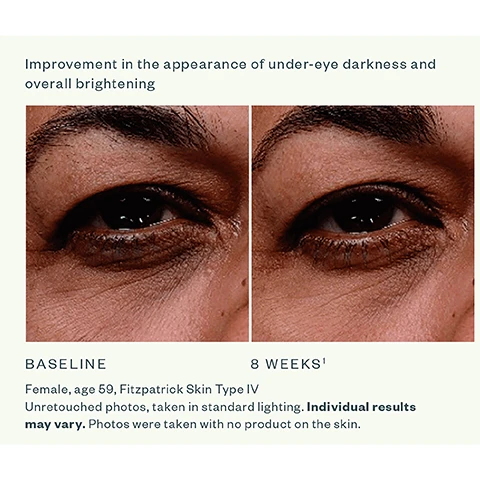 Image 1 - Image showing a comparison of two close-up photos of a womans eyes: the left image labeled BASELINE shows noticeable under-eye darkness, while the right image labeled 8 WEEKS displays improved brightness; additional text includes information about her age and skin type, noting the photos were unretouched and taken under standard lighting with no product on the skin.
Image 2 - Image comparing the area around the eyes of a 62-year-old female before and 15 minutes after application of a product, with the text stating Smooths coarse and fine lines/wrinkles, BASELINE, 15 MINUTES POST-APPLICATION, Female, age 62, Fitzpatrick Skin Type I, Untouched photos taken in visible light. Individual results may vary, and Product left on skin at 15 minutes post-application.
Image 3 - A side-by-side comparison of a 56-year-old females eyes showing improvement in under-eye bags and wrinkles after eight weeks, with text indicating the baseline on the left and eight weeks on the right, along with details about the subject and the photo conditions.
Image 4 - Image shows a collection of five SkinMedica skincare products arranged on a light background, with product names and their categories listed underneath: AHA/BHA Exfoliating Cleanser, TNS Advanced+ Serum, Instant Bright Eye Cream, HA5 Hydra Collagen Replenish + Restore Hydrator, and Essential Defense Mineral Shield Broad Spectrum SPF 35 Sunscreen.