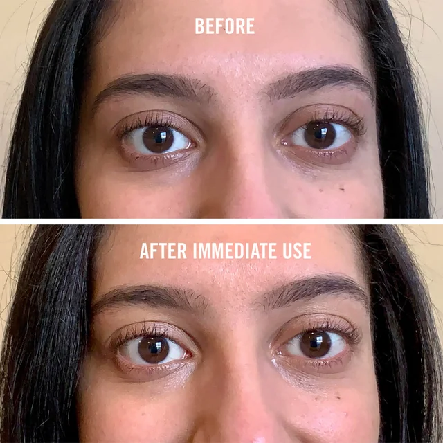 before and after