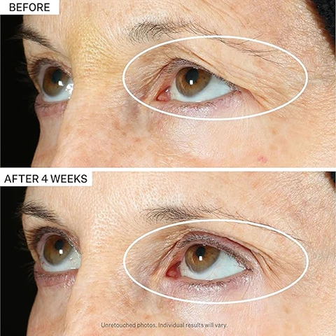 Image 1 - Image showing a side-by-side comparison of a persons eyes, with the upper half labeled Before and the lower half labeled After 4 Weeks, highlighting the improvement in the appearance of wrinkles around the eyes. Visible text includes Uretouched photos. Individual results will vary.
Image 2 - Image showing a skincare routine with illustrated product shapes labeled as Cleanser, Eye Care, Serum, Moisturizer & Neck Cream, and SPF, along with instructions for Eye Care application and timing in the sections titled Step 2: Eye Care, How to Apply, and When to Apply.
Image 3 - Image shows three circular glass dishes containing different ingredients: blue hexagonal gel labeled Triple Peptide Blend, a green fruit with brown seeds labeled Caffeine & Kakudu Plum Extract, and green strands labeled Microalgae & Marine Ferment.
Image 4 - Image depicts a diagram explaining peptides, showing three main components: amino acids, peptides, and protein, with accompanying text detailing that amino acids are building blocks of protein, describing peptide formation technology, and stating that peptides target specific skin functions. The visible text reads What are Peptides? AMINO ACID Building blocks of protein in the body and skin, of which there are 20 different types. PEPTIDE Strivectins technology allows us to form the amino acids into short chains called peptides. PROTEIN Peptides target various specific skin functions.
Image 5 - A tube of StriVectin eye serum with a cooling metal tip sits against a light background, with two drops of the serum beside it; the text on the image reads Cooling metal tip provides instant depuffing effects.
Image 6 - A clear petri dish with a light blue gel inside and a close-up of a molecular structure, accompanied by text that reads NIA-114 TECHNOLOGY and the description Our products feature NIA-114™, our patented, next-level form of Niacin/Vitamin B3 clinically proven to strengthen skin’s barrier.
Image 7 - A serum bottle with a cooling metal tip is shown beside three small drops of the product on a yellow background, accompanied by the text cooling metal tip massages.
Image 8 - A tube of StriVectin eye serum is centered against a yellow background with radiating lines, and an illustration showing an eye with the text 360 RESULTS is positioned below the tube.