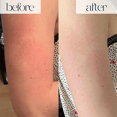 Image 1 to 5, Before and After shots from using the product