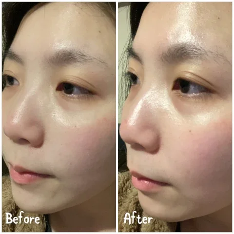 Before and After