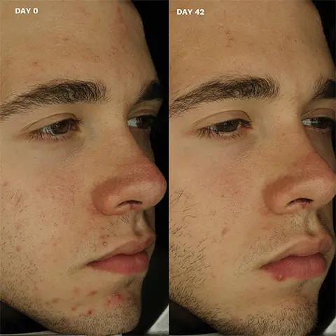 Image 1 - Day 0 vs Day 42. Image 2, Women and home Beauty Awards Winner 2022 Badge