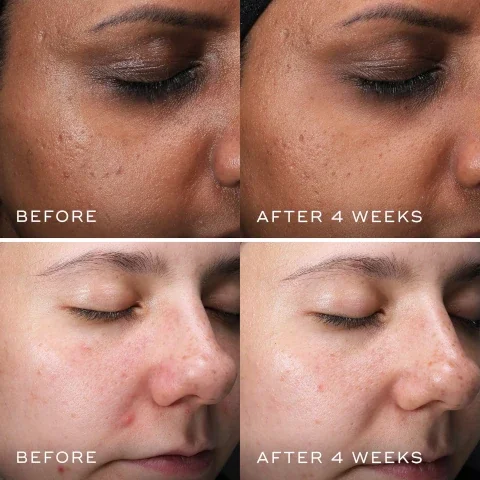 before and after 4 weeks