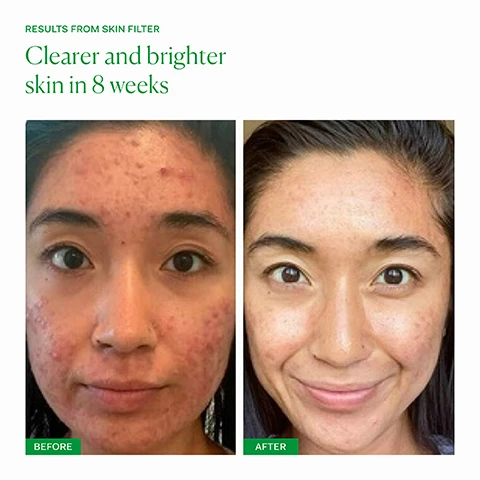 image 1 and 2, results from skin filter. clearer and brighter skin in 8 weeks. before and after. image 3, 92% agree that skin looks brighter. 90% agree that pigmentation looks reduced. consumer perception panel conducted by the nue co, april 2024, 25 respondents after two months use minimum. image 4, skinAx2 - clinically studied compound to brighten skin and reduce pigmentation. beta-carotene - natural form of vitamin a to stimulate fibroblasts and collagen. camu camu - natural source of antioxidant rich vitamin c to brighten skin and reduce dark marks. image 5, dullness, pigmentation and occasional breakouts. inner skin filter - for anyone who is looking to brighten their skin and reduce dark marks or pigmentation. clinically proven results in 60 days. one capsule daily with food. outer - skin filter serum. for anyone looking to improve skin texture, brighten skin, reduce dark marks and reduce fine lines. apply 2-3 pumps to clean, dry skin after cleansing in the PM. follow with barrier culture moisturiser. image 6, bio available vitamin a for your body to absorb. vegan, sugar free, gluten free, additive free, cruelty free, endocrine safe. clinically proven results in 60 days. image 7, old packaging vs new packaging. as our new packaging phases in sustainably, you may receive either out old or new jar and box. inside the jar it's the same formula you know and love.