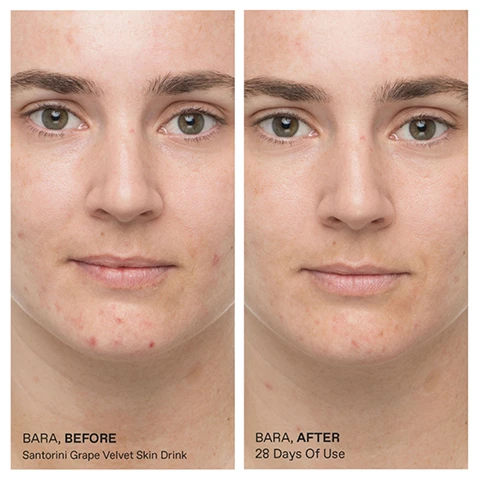 Image 1 - A before-and-after comparison of a persons face shows reduced acne and improved skin tone, with the left image labeled BARA, BEFORE Santorini Grape Velvet Skin Drink, and the right image labeled BARA, AFTER 28 Days Of Use. Image 2 - A close-up shows a persons bare shoulder and neck with glowing, moisturized skin, a hand holding a green bottle labeled Velvet Skin Drink, and overlaid text that reports 100% of users said this product immediately makes their skin feel baby soft, 100% of users saw more supple, brighter and resilient skin after 3 days, 100% of users saw and improvement in their skin imperfections after 7 days, and clarifies In a consumer perceptions study of 32 participants. Image 3 - A dropper applies a clear serum onto a persons hand, next to a green bottle, with visible text reading A Multi-Tasking Treatment: + Velvet soft skin, + No-shine glow, + Blur imperfections, + Hydrates thirsty skin, and Velvet on the bottle.