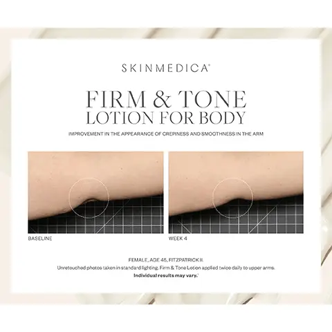 Image 1 to 3, Firm and tone lotion for body, Improvement in the appearance of crepiness and smoothness in the arm Before and After 4 weeks