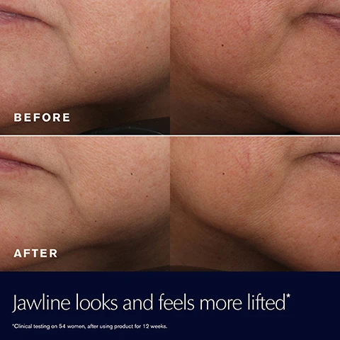 Image 1 - Split image showing before and after views of a jawline area with text BEFORE AFTER Jawline looks and feels more lifted *Clinical testing on 54 women, after using product for 12 weeks.
Image 2 - A jar of Estée Lauder Revitalizing Supreme+ Youth Power Creme Crème révélatrice de jeunesse is shown surrounded by dishes of ingredients and text indicating benefits: Hyaluronic Acid NOURISH + PLUMP, Cactus Stem Cell Extract STRENGTHEN BARRIER, Hibiscus Morning Bloom Extract LIFT + FIRM, and Moringa Extract ANTI-OXIDANT POWER, along with a swirl of cream.
Image 3 - A close-up of a woman holding a jar of Estee Lauder Revitalizing Supreme Plus Youth Power Creme with text overlay stating 90% SAID SKIN HAS MORE BOUNCE AND ELASTICITY and Consumer testing on 110 women after using product for 2 weeks.
Image 4 - A close-up portrait of a woman with glowing skin, next to the text 93% SAID SKIN LOOKS RADIANT, FEELS STRONGER Consumer testing on 110 women after using product for 2 weeks.
Image 5 - An open jar of Estée Lauder Revitalizing Supreme+ Youth Power Creme next to text that reads HAVE IT ALL: 89% SAID SKIN LOOKS MORE LIFTED¹ 95% SAID SKIN FEELS FIRMER² 87% SAID LINES & WRINKLES LOOK SIGNIFICANTLY REDUCED¹ ¹CONSUMER TESTING ON 110 WOMEN AFTER USING PRODUCT FOR 4 WEEKS. ²CONSUMER TESTING ON 110 WOMEN AFTER USING PRODUCT FOR 2 WEEKS.
Image 6 - Close-up of a womans face with cream applied to her cheek and text that reads: SILKY, COCOONING CREME 93% SAID IT PENETRATES AND MELTS DEEPLY INTO SKIN—INSTANTLY CONSUMER TESTING ON 110 WOMEN AFTER SINGLE PRODUCT APPLICATION.
Image 7 - Close-up of an open jar of Estée Lauder cream with its gold lid, showing the cream inside, next to text detailing product benefits ESTEE LAUDER Revitalizing Supreme + Youth Power Creme Crème révélatrice de jeunesse 95% said skin FEELS FRESH and comforted instantly* *Consumer testing on 110 women after single product application.
Image 8 - A jar of Estee Lauder Revitalizing Supreme+ Youth Power Creme wrapped in a golden ribbon with text beside it Look More Lifted in 3 Key Facial Zones Cheeks Smile Lines Jawline ESTEE LAUDER Revitalizing Supreme+ Youth Power Creme Crème révélatrice de jeunesse.
Image 9 - A jar of Estée Lauder Revitalizing Supreme+ cream is shown on a creamy background with text ESTEE LAUDER Revitalizing Supreme+ Youth Power Creme Creme revelatrice de jeunesse REVITALIZING SUPREME+ DOES NOT INCLUDE Parabens Phthalates Mineral Oil Sulfates Sulfites Petrolatum Drying Alcohol.
Image 10 - A jar of Estee Lauder Revitalizing Supreme+ Youth Power Creme Crème révélatrice de jeunesse is shown above text RECYCLABLE JAR HELPS REDUCE UP TO 375000 POUNDS OF PLASTIC* *COMPARED TO PREVIOUS NON-RECYCLABLE PACKAGE DESIGN BASED ON FIRST YEAR GLOBAL PRODUCTION VOLUME.
Image 11 - Three jars of Estee Lauder Revitalizing Supreme+ Youth Power Creme Crème révélatrice de jeunesse are shown in sizes 75ml, 50ml, and 30ml.
Image 12 - The image shows a Daily Skincare Regimen with text Beautiful skin starts here. All you need are a few high-performance formulas targeted to your skins specific needs, featuring three steps including 1. Serum Advanced Night Repair Serum, 2. Moisturizer Revitalizing Supreme+ Creme, and 3. Eye Cream Advanced Night Repair Eye Gel-Creme.
Image 13 - Image shows four jars of Estée Lauder skincare creams, with text More Than Moisture about lasting hydration and nourishment, and descriptions for each product DayWear Anti-Oxidant 24H-Moisture Creme SPF 15 Protect & Prevent, Revitalizing Supreme+ Youth Power Creme Lift & Firm, Revitalizing Supreme+ Bright Power Soft Creme Firm & Glow, Resilience Multi-Effect Face and Neck Creme SPF 15 Lift & Plump.