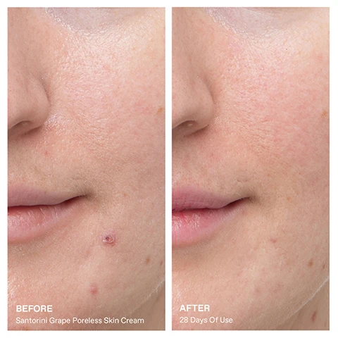Image 1 - Before and after comparison of a persons skin around the nose and mouth, showing on the left a prominent blemish and larger pores, and on the right, smoother skin with reduced pores and no blemish, with text that reads BEFORE Santorini Grape Poreless Skin Cream AFTER 28 Days Of Use. Image 2 - A cluster of green grapes on a gnarled vine with green leaves, next to text that reads Santorini Grape Extract rich in polyphenols from the volcanic ash in which it grows for excess oil removal + improved pore appearance. Image 3 - A light beige or cream-colored cosmetic product smear on a white background with text that reads: 97% REFINED PORE APPEARANCE*, 100% IMPROVED SKIN TEXTURE**, *97% of women / Use for 14 days / Self-assessment, 32 panelists between 18-35 years old., **100% of women / Use for 14 days / Self-assessment, 32 panelists between 18-35 years old.