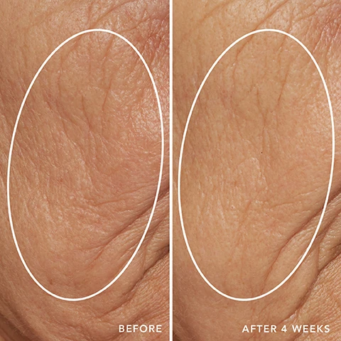 Image 1 - A split image shows a close-up of skin with a white oval highlighting an area, the left side labeled BEFORE displays pronounced wrinkles, while the right side labeled AFTER 4 WEEKS shows visibly reduced wrinkles. Image 2 - A close-up comparison of skin, with the top half showing more visible lines and dark spots labeled BEFORE, and the bottom half showing smoother skin with reduced discoloration labeled AFTER 4 WEEKS. Image 3 - A before and after close-up of skin shows a reduction in visible wrinkles and a smoother texture in the lower image, with text that reads BEFORE and AFTER 4 WEEKS. Image 4 - A close-up before and after comparison of skin, with the top image showing more visible redness and capillaries marked BEFORE, and the bottom image showing reduced redness and capillaries marked AFTER 4 WEEKS.