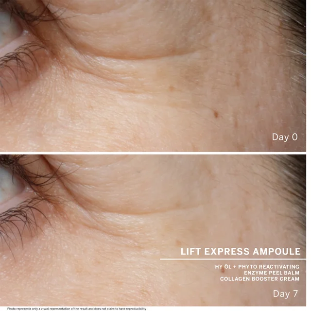 Day 0 Lift Express Ampoule Hy Öl + Phyto Reactivating Enzyme Peel Balm Collagen Booster Cream (Description: Skin before use) Day 7 Photo (Description: Crows feet are visibly reduced) Represents Only A Visual Representation Of The Result And Does Not Claim To Have Reproducibility