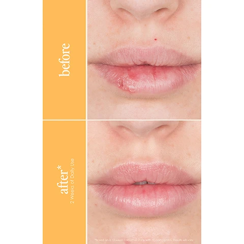 Image 1 - Side-by-side comparison of lips, with the top image labeled before showing dry and cracked lips, and the bottom image labeled after showing smooth and hydrated lips after two weeks of use.
Image 2 - A pink jar of GrandePout Plumping Lip Mask is shown on a bright yellow background, featuring text that reads get a plump pillowy pout and highlights benefits such as infused with Volulip to plump through hydration, infused with DuraQuench to lock in moisture, and helps to reduce lip lines and wrinkles.
Image 3 - A close-up of a womans face, highlighting her lips, with the text Instantly 97% felt it restored moisture to lips* After 72 Hours 100% felt more conditioned lips* over a peach-colored background.
Image 4 - A woman with long dark hair is smiling while holding a jar of lip treatment in front of a peach-colored background, with visible text reading hydrating + plumping and a quote that says Its been 3 weeks and my lips are never chapped anymore!
Image 5 - A person holds a jar of GrandePOUT Plumping Lip Mask while smiling, with the text 97% felt it repairs dry, flaky lips* visible in the image.
