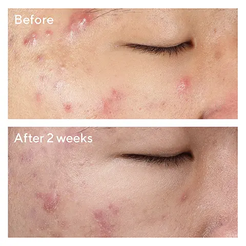 Image 1 and 2- Before and after model shots after use