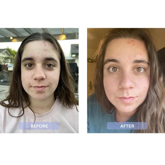 before and after
