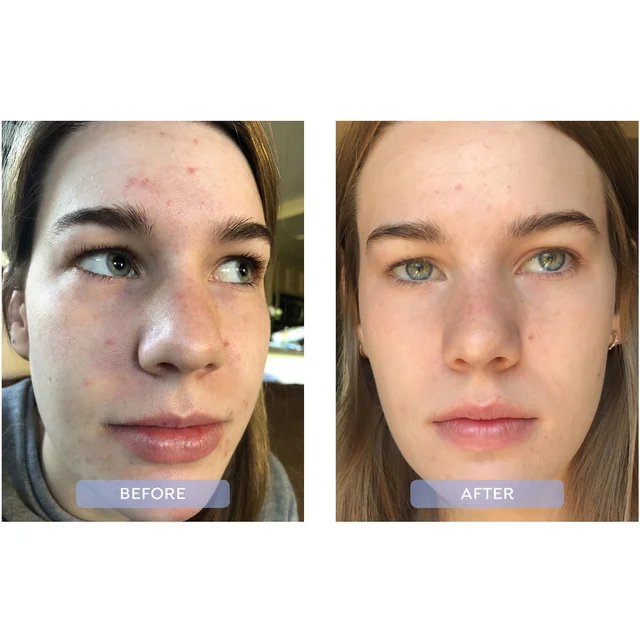 before and after