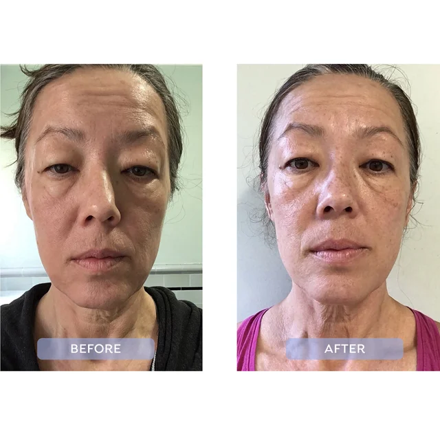 before and after