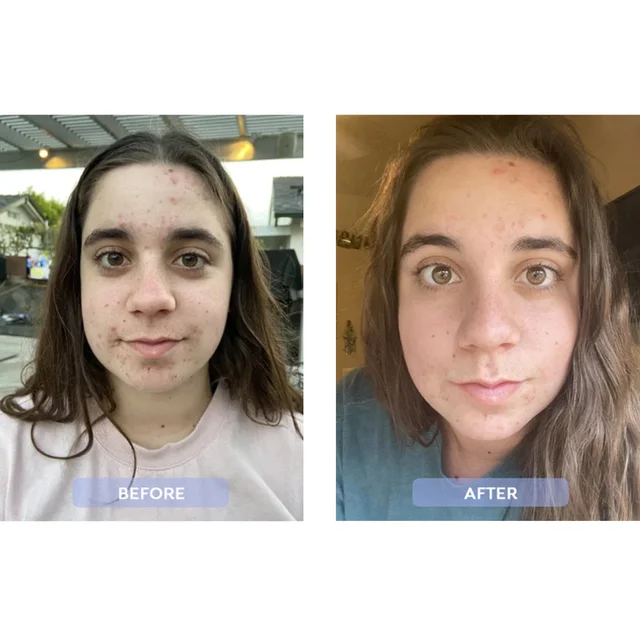 before and after