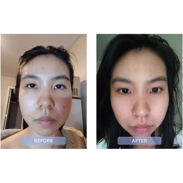 before and after