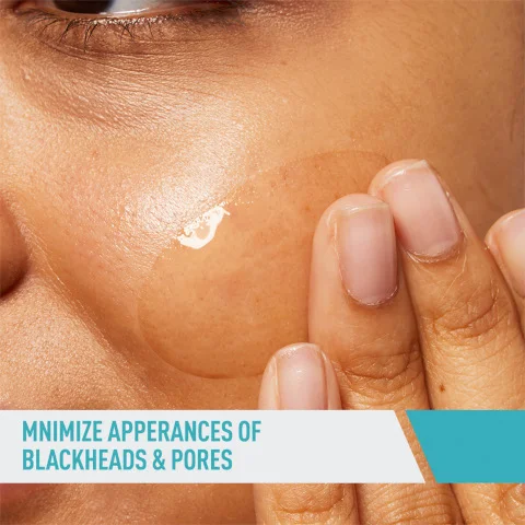 minimize the appearances of blackheads and pores