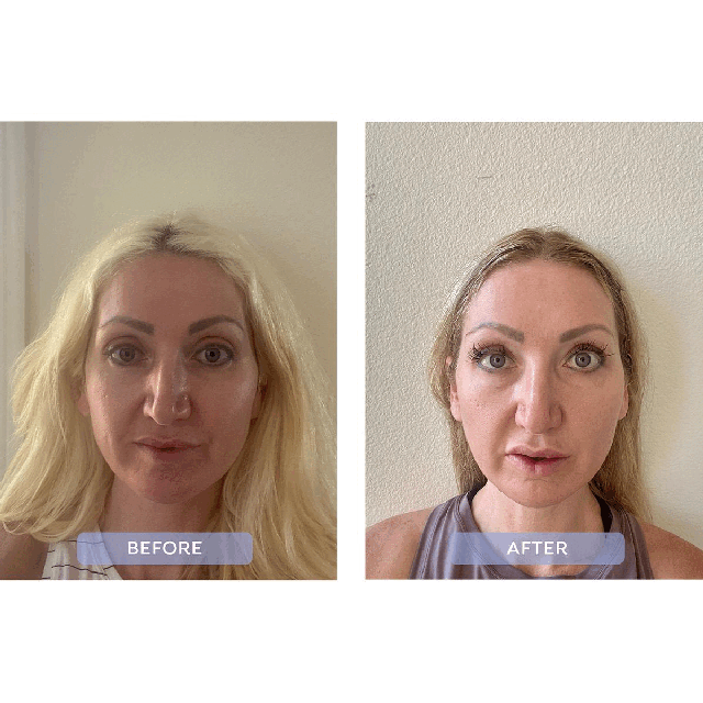Image 1-2, before and after
