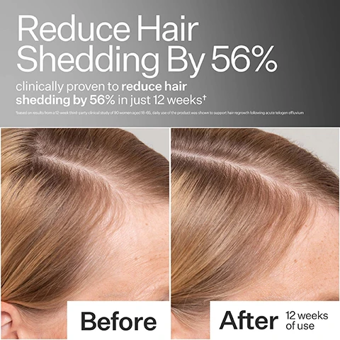 Image 1 - A before and after comparison image of a womans scalp and hair shows visibly denser hair in the After image on the right, taken 12 weeks after the Before image on the left, with overlay text stating Reduce Hair Shedding By 56% clinically proven to reduce hair shedding by 56% in just 12 weeks and a disclaimer *based on results from a 12-week third-party clinical study of 90 women aged 18-65, daily use of the product was shown to support hair regrowth following acute telogen effluvium. Image 2 - A hand holds a bottle of Act+ Acre Cold Processed Stem Cell Scalp Serum, 2.2 fl oz – 65 ml e, next to a graphic displaying Visible Results and a circular chart indicating 90% saw new hair growth in 6 weeks, based on consumer perception results from a 6-week third-party clinical study of 30 women aged 18-59, where daily use of the product was shown to support hair regrowth following acute telogen effluvium. Image 3 - A before and after image comparison showing a scalp with thinning brown hair on the left and thicker, denser brown hair on the right, with text that reads 90 Days To Thicker Looking Hair, Before, and After 12 weeks of use. Image 4 - Four frosted glass dropper bottles with white caps are arranged on a reflective surface, accompanied by text detailing product benefits over time: What To Expect, day 30 scalp will feel hydrated + balanced, day 60 visibly less fall out + baby hairs appear, day 90 hair will feel thicker + fuller, and each bottle is labeled Act+ Acre. Cold Processed Stem Cell Scalp Serum 2.2 fl oz - 65 ml e. Image 5 - A close-up view shows a clear dropper applying liquid to a persons scalp and dark hair, alongside text that reads Hyaluronic Acid 0.1% hydrates deeply + reduces scalp irritation and Apple Stem Cells help to activate scalp cell regeneration + hair growth. Image 6 - A close-up image of a clear glass dropper on a light background, surrounded by text connected by arrows that reads: non-greasy, no silicones, no synthetic fragrances, and no residue. Image 7 - A product guide displays four Act+Acre scalp serum bottles, each with a white cap, organized by category with the prominent text What Serum Is Right For You? Categories and their associated product details include: Thick + Full with Act+Acre Cold Processed Stem Cell Scalp Serum and Stem Cell Scalp Serum™; Hydrate + Repair with Act+Acre Daily Hydro™ Scalp Serum and Daily Hydro Scalp Serum™; Control Oil with Act+Acre 4% Niacinamide Oily Scalp Serum and 4% Niacinamide Oily Scalp Serum; and Scalp Relief with Act+Acre Microbiome Cooling Scalp Serum and Microbiome Scalp Serum, with all bottles indicating 2.2 fl oz - 65 ml e. Image 8 - A promotional image displays three Act+Acre hair products including Plant Based Stem Cell Shampoo, Plant Based Stem Cell Conditioner, and Cold Processed Stem Cell Scalp Serum, presented with their routine steps and benefits, under the title Complete Your Routine and a Trichologist Recommended badge; visible text includes Complete Your Routine, TRICHOLOGIST RECOMMENDED Helen Reavey, Act+Acre Plant Based Stem Cell Shampoo 10 fl oz - 296 ml e, Act+Acre Plant Based Stem Cell Conditioner 10 fl oz - 296 ml e, Act+Acre Cold Processed Stem Cell Scalp Serum 2.2 fl oz - 65 ml e, step 1 Stem Cell Shampoo Benefits cleanses + nourishes, step 2 Stem Cell Conditioner Benefits hydrates + strengthens, and step 3 Stem Cell Scalp Serum Benefits promotes thicker, fuller looking hair. Image 9 - A frosted glass bottle of Act+Acre Cold Processed Stem Cell Scalp Serum with a dark gray cap is displayed, noting a 2 Month Supply of 2.2 oz or 65 ml. Image 10 - A bar graph shows that 97% of nutrients are retained with Cold Processed® and 10% are retained with heat processing, displayed next to a clear glass pipette, with the visible text: Why Cold Processed® †Cold Processing preserves active ingredients, heat destroys them.