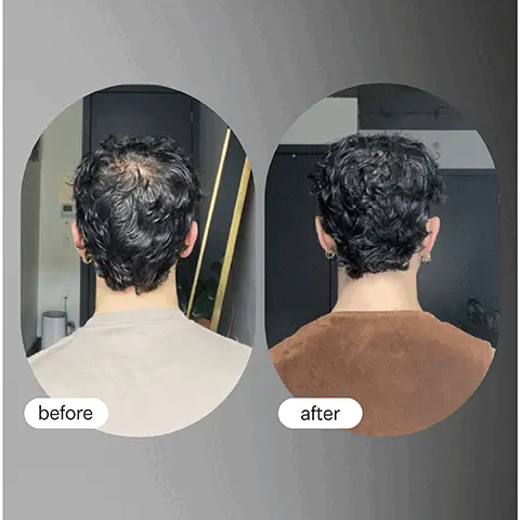 Image 1 and 2, before and after. Image 3, Loved by Goop, Forves, Coveteur, Elite Daily, Byrdie