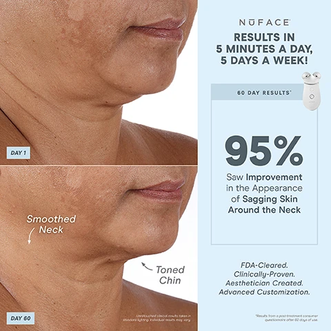 Image 1, day 1 vs day 60, smoothed neck and toned chin. unretouched clinical results taken in standard lighting - individual results may vary. results in 5 minutes a day, 5 days a week. 60 day results - 95% saw improvement in the appearance of sagging skin around the neck. FDA cleared, clinically proven, aesthetician created, advanced customization. results from a post treatment consumer questionnaire after 60 days of use. image 2, 1 device, 3 attachments, endless treatments. built in skin sensor, automatically turns on when placed on skin. smart device technology - perfect for advanced customisation. wrinkles reducer attachment - helps reduce full face wrinkles with a combination of red, amber and infrared lights. FDA cleared, clinically poven, aesthetician created. unlock exclusive treatments, bluetooth enabled pair with the nuface smart app. image 3, help reduce lines and wrinkles. under eye, on forehead, around the mouth, around the eyes. image 4, before and after, lifted hooded eyelid and brow and lifted jaw. unretouched clinical results taken in standard lighting, individual results may vary. instant results in 5 minutes. immediate results - 90% saw a lifted appearance. FDA cleared, clinically proven, aesthetician created, advanced customisation. image 4, day 1 vs day 60 - reduced deep lines. unretouched clinical results take in standard lightening, individual results may vary. results in 5 minutes, 5 days a week. 60 day results, 93% saw reduction in the appearance of deep lines. FDA cleared, clinically proven, aesthetician created, advanced customisation. image 5, 1 device, endless customisable results. instant results that build with consistent use. contour - cheeks. lift - eyes and brows. tone - jowls and jawline. smooth - neck and forehead. lift - lips and smile lines. with effect lip and eye attachment. image 6, microcurrent 101. a low level electrical current that mimics and re-energises the body's natural current to tone, lift and contour down to the muscles. skincare is your nutrition. microcurrent is your fitness. trinity+ is fitness for your face. image 7, unlock app exclusive treatments to target different layers of skin and muscles. help reduce wrinkles and pump skin with skin tightening mode - epidermis. helps instantly lift and contour with instant lift mode - hypodermis. long term muscle sculpting with pro toning mode - muscle. after 15 minutes of use, after 14 days of use. unlocked with the nuface app. image 8, smart app. follow step by step tutorials, track progress. customise results with app exclusive treatments. set treatment reminders. image 9, comparison of three nuface devices. trinity+ advanced customisation. unlock app exclusive treatments - yes. boost with 25% microcurrent - yes. nuface smart app - yes. attachment options (eye and lip attachment and LEF red light attachment sold separately - yes. microcurrent treatment areas - jowls and jawline, neck, cheeks and forehead, around eyes and brows, around mouth and lips, smile lines. mini+ on the go lifting. unlock app exclusive treatments - yes. boost with 25% microcurrent - no. nuface smart app - yes. attachment options (eye and lip attachment and LED red light attachment sold separately - no. microcurrent treatment areas - jowls and jawline, neck, cheeks and forehead. fix, instant finisher.