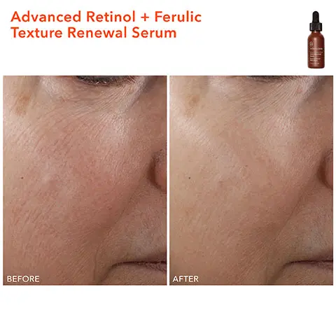 Image 1 & 2, Before and After images showing the results of using Advanced Retinol and Ferulic Texture Renewal Serum. Skin appears brighter and smoother in the first after shot. The second shows how fine lines around the eye have been reduced. Image 3, Before and After shot showing the results of using Advanced Retinol and Ferulic Intense Wrinkle Cream. The after shot shows how skin appears smoother and firmer after use