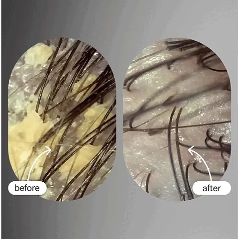 Image 1 and 2, before and after. Image 3, loved by: vogue, coveteur, allure, forbes and elite daily.