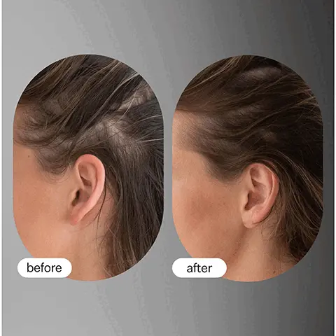 Image 1, before and after. Image 2, loved by: vogue, coveteur, allure, forbes and elite daily.