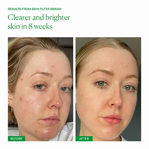 image 1, results from skin filter serum, clearer and brighter skin in 8 weeks. before and after. image 2, AHAs - glycolic, lactic, mandelic, malic, tartaric and citric acids unglue dead skin cells to smooth and brighten. bakuchiol and rambutan - plant based alternative retinols deliver results with no irritation. hyaluronic acid - holds up to 1000 times its weight in water to deeply hydrate. image 3, irritation free plant based formula. approved skin microbiome and skin barrier friendly. free from silicones, fragrances, common irritants and any skin barrier damaging ingredients. image 4, dullness, pigmentation and occasional breakouts. inner skin filter - for anyone who is looking to brighten their skin and reduce dark marks or pigmentation. clinically proven results in 60 days, one capsule daily with food. outer skin filter serum - for anyone looking to improve skin texture, brighten skin, reduce dark marks and reduce fine lines. apply 2-3 pumps to clean, dry skin after cleansing in the PM. follow with barrier culture moisturiser. image 5, old packaging vs new packaging. as our new packaging phases in sustainably, you may receive either out old or new jar and box. inside the jar it's the same formula you know and love.