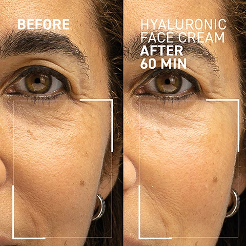 Image 1 - A close-up of a womans face showing her eyes and skin texture, with BEFORE on the left and HYALURONIC FACE CREAM AFTER 60 MIN on the right.
Image 2 - A close-up portrait of a woman with skincare cream applied to her face, displaying the text 100% reported hydrated and replenished skin for up to 72 hours, 97% reported a reduction of wrinkles and expression lines, and includes footnotes.
Image 3 - A woman with short gray hair is applying face cream to her cheek, with several white cream lines visible on her face, and the image features the text FILL IN THE LINES along with benefits of the product including Intense hydration deep into skin, Plumps the skin, filling out fine lines and wrinkles, Helps restore definition to facial contours, and a jar labeled Dr. BRANDT Hyaluronic Face Cream.
Image 4 - Image features a jar of Dr. Brandt Hyaluronic Face Cream on a light blue background, with a close-up of a gel-like substance and a metallic spoon, accompanied by text that reads HYDROPEPTIDES optimize the efficacy of hyaluronic acids in skin and HA4 four types of hyaluronic acid to replenish water and hydrate.
Image 5 - A jar of Dr. Brandt Hyaluronic Face Cream with the lid off, showing the white cream inside, and a small amount of cream on a surface beside the jar, with visible icons indicating it is made from 97% natural ingredients, paraben-free, sulfate-free, GMO-free, vegan, and cruelty-free.
Image 6 - A step-by-step skincare routine visual with five labeled icons representing products: cleanse, exfoliate, treat, moisturize, and protect, along with instructions for how to apply moisturizer after serum and when to do it daily in the morning and evening.