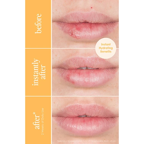 Image 1 - Image showing three close-up photos of lips with varying conditions labeled as before, instantly after, and after with the note 2 weeks of daily use, alongside a circular graphic stating Instant Hydrating Benefits.
Image 2 - Image of a lip scrub product against a vibrant orange background, featuring a jar labeled Lip Buff Exfoliating Lip Scrub and a pink lip scrub texture, accompanied by bullet points that describe its features: exfoliates for instantly softer & smoother lips, infused with mango butter & argan oil, gentle enough for daily use, prep lips + improves makeup wear.
Image 3 - A close-up image of a jar of Grande BUFF Moisturizing Lip Scrub positioned on a light pink surface, featuring visible text that reads 96% felt it instantly polished and moisturized lips* and 97% saw healthier, revitalize looking lips*.
Image 4 - A close-up image of a persons lips, showcasing a smooth, glossy finish, with the text soft, kissable lips above and great to get off dead, dry skin on your lips leaving them soft and supple below.