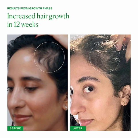 image 1, results from growth phase. increased hair growth in 12 weeks. before and after. image 2, 90% reduction in hair shedding. 87% reduction in hair breakage. 40% increase in hair growth. independent blind clinical trial with 33 respondents.