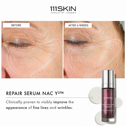 Image 1 - Before and after images of an eye area showing visible improvement in fine lines and wrinkles after six weeks of using 111SKIN Repair Serum NAC Y2™, with text stating REPAIR SERUM NAC Y2™ Clinically proven to visibly improve the appearance of fine lines and wrinkles.
Image 2 - A close-up of a womans face with a clear skincare product applied to her cheek, featuring text that says 2 WEEKS, PROVEN TO RESTORE HEALTHY SKIN IN 2 WEEKS*, 92% AGREE FINE LINES ARE VISIBLY REDUCED**, and 92% AGREE SKIN HAS A HEALTHY GLOW**.