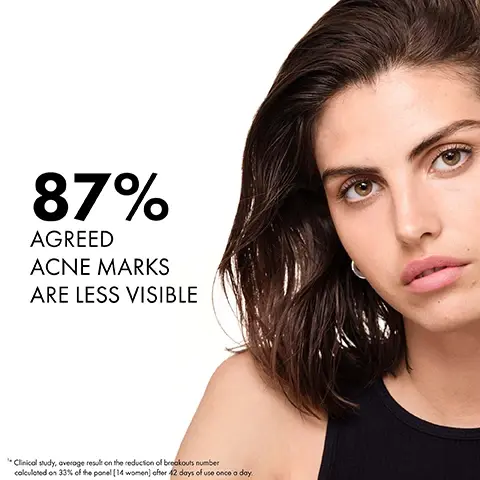 Image 1 - A close-up of a young woman with wavy brown hair looking towards the camera, accompanied by text stating 87% agreed acne marks are less visible, with a small disclaimer below.
Image 2 - Image shows two sections with textures resembling clear liquids; left side labeled 1% Salicylic Acid and highlights clears acne & prevents new breakouts, right side labeled 4% Glycolic Acid and highlights exfoliates & renews the skins surfaces.
Image 3 - A close-up of a womans face showing three drops of clear skincare product on her cheek and the text non-greasy, non-sticky, fast absorbing texture.
Image 4 - A hand holds a green bottle with a clear tip dispensing a drop of liquid, with instructions below reading 1 TURN BOTTLE UPSIDE DOWN & SQUEEZE CLEAR TIP TO DISPENSE 2 APPLY SEVERAL DROPS TO A CLEAN AND DRY FACE TO TARGET ACNE BREAKOUTS.
Image 5 - A hand holds a green bottle of Vichy Normaderm BHA Exfoliating Serum with visible icons and text stating Allergy Tested, Fragrance Free, and Dermatologist Tested for Safety, along with a certification label for dermatologists developed by Vichy Laboratories.