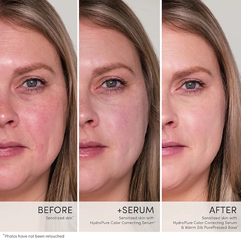 Image 1, before = sensitized skin, with serum = sensitized skin with hydro pure color correcting serum, after = sensitized skin with hydro pure color corrective serum and warm silk pure pressed based. photos have not been retouched. Image 2, before = 12 hours after IPL laser, plus serum = 12 hours after IPL laser with hydra pure color correcting serum. after = 12 hours after IPL laser with hyrdo pure color correcting serum and latte pure pressed based. *photos have not been retouched. Image 3, visually neautralizes redness, improves foundation performance, hydrates and soothes irritation, supports smoother, firmer skin. Image 4, before immediately after radio frequency micro needling. after immediately after radio frequency micro needling with hydro pure color correcting serum. photos have not been retouched. Image 5, choose how to wear hydro pure color correcting serum. wear alone in a sheer layer to minimize the appearance of redness. use after or in place of smooth affair brightening face primer. layer under foundation to achieve fuller more even coverage.