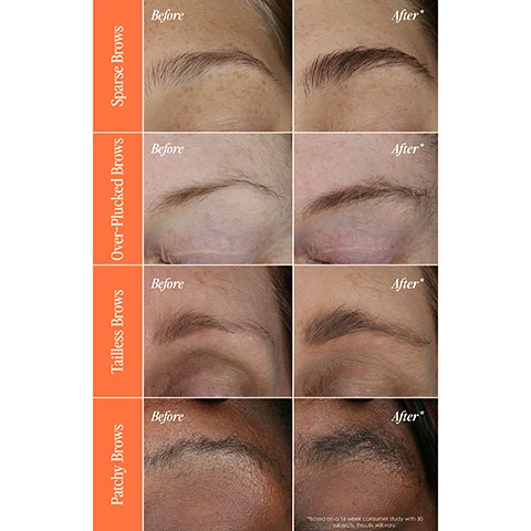 Image 1 - Image showing four sets of eyebrow transformations with Before and After labels for each category: Sparse Brows, Over-Plucked Brows, Tailless Brows, and Patchy Brows, indicating improved eyebrow appearance.
Image 2 - A woman with curly hair holds a brow product up to her face, with the background featuring text that reads 6-8 weeks 100% saw fuller, bolder looking brows* and 4 months full improvement for sparse, thinning, or over-plucked brows*.
Image 3 - Image of a brow enhancing serum product with an orange background, featuring the text that describes it as award-winning brow enhancing serum, and lists benefits such as promoting fuller brows in 6-8 weeks, being suitable for sparse or over-plucked brows, ease of use with application only once daily, and being dermatologist tested.
Image 4 - A close-up image of a young womans face showing her applying eyebrow serum with a brush, with three text bubbles that say apply 1x daily, apply to natural brow shape and allow 1-2 minutes for serum to dry, and concentrate specifically on sparse, thinning, over-plucked, or tail-less areas.
Image 5 - Image features a bottle of GrandeBROW Brow Enhancing Serum against an orange background, with the text this definitely works! and below it, I just started using this but if its anything like the lash serum, I know Ill see amazing improvements.
Image 6 - An image showing two sizes of GrandeBROW brow enhancing serum, with the travel size labeled 8 Week Supply 1.5ML and the full size labeled 4 Month Supply 3ML, alongside text indicating expected results at weeks 6-8 as Perfect to try Im starting to see initial results! and at week 16 as Full Results My brows look UNREAL!
