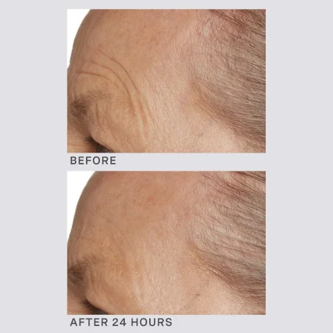 before and after 24 hours