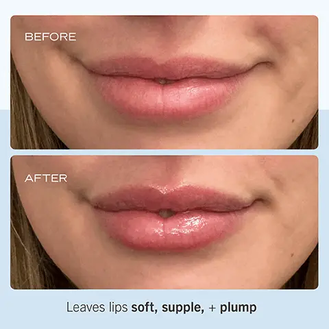 Image 1, BEFORE AFTER Leaves lips soft, supple, + plump Image 2, Instantly hydrates with a subtle sheen TRAREPAIRUP BAUME LEVE ULTRAREPARAT NET WT6025 Image 3, Butters Concentrated formula Waxes locks in moisture to Botanical Oils nourish distressed lips Image 4, BAUME A LEVRES ULTRA RÉPARATEUR NETWT. 69 (0.25 02) o Rich, Buttery Texture o Cruelty-Free o Free of Fragrance, Flavor + Color ULTRA REPAIR LIP BALM BAUME À LÈVRES ULTRA RÉPARATEUR NET WT. 69 (0.250Z) ULTRA REPAIR LIP BALM ULTRA REPAIR LIP BALM NET WT. 6 g (0.25 02) ULTRA RÉPARATEUR BAUME À LÈVRES