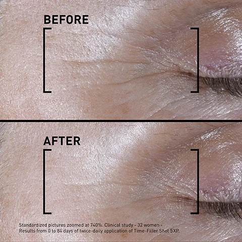 Image 1, before and after. standardized pictures zoomed in at 740%. clinical study - 32 women - results from 0 to 84 days twice daily application of time filler shot 5XP. image 2, smooth 5 expression lines in 7 days. clinical study 32 volunteers, 7 days of twice daily application. image 3, 84% of women observed. relaxed features in 7 days. self assessment 32 women, 7 days of twice daily use. image 4, neuropeptidic active ingredients. inspired by botulinum injections. patent pending. image 5, apply with the applicator on the 5 expression lines. morning and evening. image 6, smoothing lotion, wrinkles correction cream. intensive serum. targeted serum. eye cream