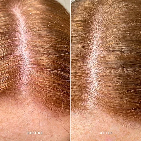 before and after