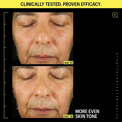 0.1% Encapsulated Retinal, 6 Peptides 2% Ornithine & EGCG Complex, 8.7% Ceramide & Omegas Complex. 11x faster3 & 3x more bio-active2 than Retinol. 2Saurat, J. H., Didierjean, L., Masgrau, E., Piletta, P. A., Jaconi, S., Chatellard-Gruaz, D., Gumowski, D., Masouyé, I., Salomon, D., & Siegenthaler, G. (1994). Topical Retinaldehyde on Human Skin: Biologic Effects and Tolerance. Journal of Investigative Dermatology, 103(6), 770-774. 3Siegenthaler, G., Jean-Hilaire Saurat, & Ponec, M. (1990). Retinol and retinal metabolism. Relationship to the state of differentiation of cultured human keratinocytes. Biochemical Journal, 268(2), 371–378.