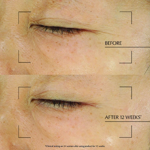 Image 1 - Before and after image of skin around an eye showing reduced wrinkles, with text BEFORE, AFTER 12 WEEKS*, and *Clinical testing on 34 women after using product for 12 weeks.
Image 2 - A close-up of a woman applying cream to her cheek with text that reads BOOST YOUR SKINS BOUNCE AT NIGHT -15% VISIBLE LINE REDUCTION IN ONE SLEEP* +20% RADIANCE BOOST UPON WAKING* +15% SMOOTHER FEELING UPON WAKING* *Clinical testing on 25 women 12 hours after a single nighttime product application.
Image 3 - An open jar of Estee Lauder Revitalizing Supreme+ Night Power Bounce Creme with its lid next to it, and text overlaid reading TRANSFORMATIVE TEXTURE MELTS FROM RICH TO WEIGHTLESS PLUMPS AND HYDRATES WRINKLES AND OILY PORES LOOK REDUCED ESTĒE LAUDER Revitalizing Supreme+ Night Power Bounce Creme Crème de nuit repulpante.
Image 4 - A close-up, split image of facial skin showing the skin condition before and after 12 weeks with the text BEFORE, AFTER 12 WEEKS*, and * Clinical testing on 34 women after using product for 12 weeks.
Image 5 - Close-up of a face with a swipe of white cream on the cheekbone next to the text TRANSFORMATIVE TEXTURE MELTS FROM RICH TO WEIGHTLESS.
Image 6 - A jar of Estee Lauder Revitalizing Supreme+ Night Power Bounce Creme is shown on a blue bubbly background with the text BOOST YOUR SKINS BOUNCE AT NIGHT IN JUST 4 HOURS SKIN IS BOUNCIER* ESTÉE LAUDER Revitalizing Supreme+ Night Power Bounce Creme Crème de nuit repulpante *Clinical testing on 28 women after 1 product application.
Image 7 - Image shows two jars of Estee Lauder Revitalizing Supreme+ cream, one for day and one for night, with text FROM 30 YEARS OF COLLAGEN RESEARCH FOR DAY LIFT & FIRM IN 3 KEY ZONES ESTEE LAUDER Revitalizing Supreme+ Youth Power Creme Crème révélatrice de jeunesse FOR NIGHT BOUNCE BACK IN JUST 4 HOURS* *Clinical testing on 28 women, after 1 product application.
Image 8 - Image shows six Estée Lauder skincare products arranged as a ritual with text THE DREAM SKIN RITUAL and steps 1 CLEANSING BALM, 2 RESCUE SOLUTION, 3 REPAIR SERUM, 4 EYE GEL-CREME, 5 NEW NIGHT CREME, 6 NEW OVERNIGHT TREATMENT.