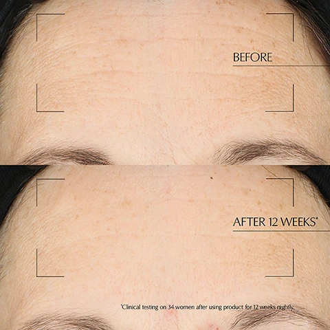 Image 1 - Image shows a comparison of a persons forehead before and after using a skincare product, with BEFORE labeled above the top section and AFTER 12 WEEKS above the bottom section, along with a note stating *Clinical testing on 34 women after using product for 12 weeks nightly.*
Image 2 - A jar of Estée Lauder Advanced Night Repair Overnight Treatment is displayed among glass containers with various powders and creams, featuring text that highlights its ingredients: exclusive night peptide for nightly renewal, hyaluronic acid + polyglutamic acid for intense moisture recovery, and 13% lipid infusion for powerful barrier recovery.
Image 3 - A woman with glowing skin holds a jar of Estée Lauder Advanced Night Repair and looks at the camera, with text that says 95% said skin feels recharged upon waking.
Image 4 - Image shows a side-by-side comparison of skin on a forehead, with the top labeled BEFORE showing visible texture and the bottom labeled AFTER 12 WEEKS showing smoother skin; additional text at the bottom reads Clinical testing on 34 women after using product for 12 weeks nightly.
Image 5 - A woman with a smooth complexion is applying a white skincare product to her cheek, while a dark background highlights the image; visible text includes LOCKS IN YOUR NIGHTTIME SKINCARE, 90%, and SAID IT MELTS INTO SKIN ON CONTACT * with a footnote stating *Consumer testing on 163 women after 1 product application.
Image 6 - A smiling woman with medium skin tone and dark hair holds a jar of Estee Lauder Advanced Night Repair cream, with a blue background displaying text that states triple-action night recovery and shows percentages for moisture, barrier, and visible energy improvements.
Image 7 - A close-up image of four smooth, crescent-shaped cream swatches on a light background, with the text COCOONS. SMOOTHS. SOOTHES. and 95% SAID SKIN FEELS SOFT AS SATIN UPON WAKING* *Consumer testing on 163 women after using product for 4 weeks, nightly.
Image 8 - A woman with glowy skin is gently touching her neck, with her eyes closed and a serene expression, accompanied by the text SKIN LOOKS LIKE IT GOT 2 NIGHTS OF SLEEP IN 1.
Image 9 - Arranged skincare products from Estee Lauder include a cleansing balm, rescue solution, advanced night repair serum, repair serum, eye gel-crème, new night cream, and overnight treatment, with the text THE NIGHT REPAIR RITUAL above.