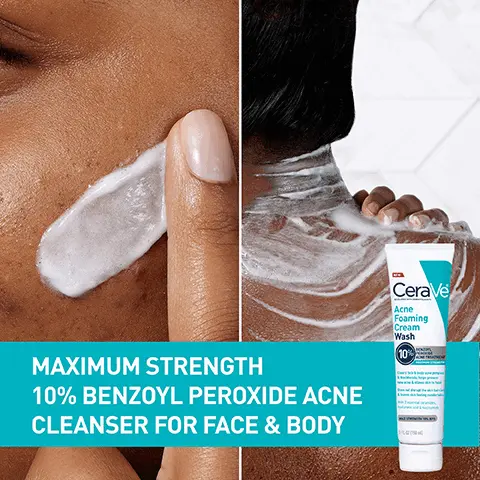 Image 1, MAXIMUM STRENGTH 10% BENZOYL PEROXIDE ACNE CLEANSER FOR FACE & BODY CeraVe Acne Foaming Cream Wash 10% Image 2, (10%) BENZOYL PEROXIDE 10% Benzoyl Peroxide Clears & treats active acne SENTIA Ceramides 1, 3, 6-11 AMIDES CERAMIDE B3 VITAMIN Helps avoid disruption to the skin's natural barrier Hyaluronic Acid Helps retain skin's natural moisture Niacinamide Helps calm skin Image 3, PREVENTS NEW BREAKOUTS AND HELPS TO CALM SKIN Image 4, DEVELOPED WITH Developed with Dermatologists FRAGRANCE Fragrance-Free WON'T Ω CLOG PORES Non-Comedogenic CeraVe Acne Foaming Cream Wash 10% BENZOYL PEROXIDE ACNE TREATMENT Cars face & body acne pig Wackheads, helps preven wache & allows ski s not disrupt the skin ba eves skin feeling com 3 essential cord c acid & nacimie L 02 (150 ml) PARABEN Paraben Free