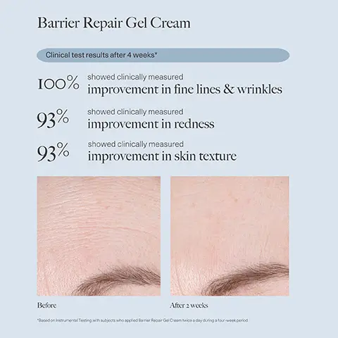 Image 1, Barrier Repair Gel Cream Clinical test results after 4 weeks* 100% showed clinically measured improvement in fine lines & wrinkles 93% showed clinically measured 93% improvement in redness showed clinically measured improvement in skin texture Before After 2 weeks *Based on Instrumental Testing with subjects who applied Barrier Repair Gel Cream ice a day during a four-week period Image 2, Barrier Repair Gel Cream Consumer perception survey results after 4 weeks* 100% agreed this product hydrates skin without feeling oily lightweight & non-irritating 93% agreed this product is 93% agreed their skin feels softer & smoother Before After 4 weeks "Based on Consumer Perception Recus with subjects who applied Barrier Repair Gel Cream aice a day during a four-week period