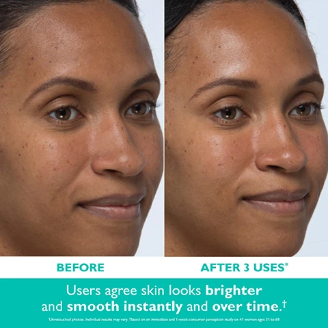 Image 2 - A before and after image shows a womans face with the left side labeled BEFORE, displaying skin with some uneven tone, and the right side labeled AFTER 3 USES*, showing brighter and smoother looking skin, with additional text that reads Users agree skin looks brighter and smooth instantly and over time.† and *Untouched photos. Individual results may vary. †Based on an immediate and 1-week consumer perception study on 41 women ages 31 to 69. Image 3 - A woman applies a facial product to her cheek with a cotton swab, illustrating the instructions HOW TO PEEL FOR YOUR INSTANT REVEAL: 1 Swipe peel-soaked swab onto cleansed face. 2 Leave peel on for up to 10 minutes. 3 Rinse to neutralize. Image 4 - A white Peter Thomas Roth Even Smoother facial peel packet with a cotton swab being pulled out, against a teal background, reads PETERTHOMASROTH CLINICAL SKIN CARE EVEN SMOOTHER INSTANT REVEAL FACIAL PEEL GOMMAGE À ACTION INSTANTANÉE 30% glycolic acid solution for brightening & smoothing 1 cotton swab/coton-tige and PRE-SOAKED FOR EASY AT-HOME APPLICATION. Image 5 - A Peter Thomas Roth Even Smoother Instant Reveal Facial Peel cotton swab partially emerges from its white and green packaging on a teal background, with text reading 30% GLYCOLIC ACID SOLUTION provides intensive exfoliation for expert-level smoothing results, NIACINAMIDE helps brighten and improve the look of uneven tone, HYALURONIC ACID & HYDROLYZED COLLAGEN leave skin feeling soft and balanced, and on the packaging, CLINICAL SKIN CARE, PETERTHOMASROTH, EVEN SMOOTHER, INSTANT REVEAL FACIAL PEEL, GOMMAGE À ACTION INSTANTANÉE, 30% glycolic acid solution for brightening & smoothing, 1 cotton swab/coton-tige. Image 6 - A young woman with smooth, clear skin holds a cotton swab to her chin against a teal background, with text that reads INSTANTLY + OVER TIME skin looks smooth and clear, with a youthful glow* and a small asterisk note *Based on an immediate and 1-week consumer perception study on 41 women ages 31 to 69. Image 7 - The image displays two Peter Thomas Roth Even Smoother Instant Reveal Facial Peel sachets, one with an old dark red top and the other with a new teal top, accompanied by text: NEW LOOK, SAME RESULTS! CLINICAL SKIN CARE EVEN SMOOTHER INSTANT REVEAL FACIAL PEEL GOMMAGE À ACTION INSTANTANÉE 30% glycolic acid solution for brightening & smoothing 1 cotton swab/coton-tige NEW. Image 8 - The image displays two Peter Thomas Roth exfoliating skincare products and a comparison table on a teal background, with text reading: PICK YOUR PTR EXFOLIANT; the left product is a jar of CLINICAL SKIN CARE EVEN CLEARER MAX COMPLEXION CORRECTION PADS containing 2% salicylic acid + 10% glycolic acid complex, aloe vera, chamomile, green tea, for clear breakouts, exfoliate skin, cleanse pores, acne treatment, for all skin types, 60 PADS, by PETERTHOMASROTH; the right product is a packet of PETERTHOMASROTH CLINICAL SKIN CARE EVEN SMOOTHER INSTANT REVEAL FACIAL PEEL, GOMMAGE À ACTION INSTANTANÉE, 30% glycolic acid solution for brightening & smoothing, 1 cotton swab/one-dip; the comparison table shows BEST FOR: breakout prevention + pore control (left) and brightening + uneven texture (right); INGREDIENTS: 2% Salicylic Acid, 10% Glycolic Acid Complex (left) and 30% Glycolic Acid Solution, Niacinamide (right); HOW TO: use up to 2x daily, no rinsing (left) and use up to 3x weekly, rinse off (right). Image 9 - Four Peter Thomas Roth skincare products, consisting of a tube, a jar of exfoliating pads, a packet of facial peel swabs, and a jar of mask, are displayed on a light mint green background, with the visible text EVEN CLEARER™ + EVEN SMOOTHER™ FRESH COMPLEXION ESSENTIALS, followed by descriptions for each product: WEEKLY EXFOLIANT decongest + purify clogged pores: PETERTHOMASROTH EVEN SMOOTHER MICRODERMABRASION EXFOLIATING PORE PURIFIER 50 ml / 1.7 fl oz; DAILY EXFOLIATING PADS breakout prevention + pore control: PETERTHOMASROTH EVEN CLEARER MAX COMPLEXION CORRECTION PADS ACNE TREATMENT 60 PADS; WEEKLY PEEL SWABS brighten + smooth: PETERTHOMASROTH EVEN SMOOTHER INSTANT REVEAL FACIAL PEEL; and TREATMENT MASK treat + eliminate active breakouts: PETERTHOMASROTH EVEN CLEARER THERAPEUTIC SULFUR MASK ACNE TREATMENT 150 ml / 5.1 fl oz.