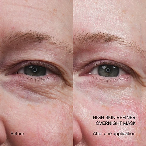 Image 1 - A close-up of a persons face showing the area around their eyes, with the left side labeled Before and the right side labeled After one application of a product called HIGH SKIN REFINER OVERNIGHT MASK.
Image 2 - A round, textured jar of Babor High Skin Refiner Overnight Mask is displayed against a gradient background with the text ENHANCE YOUR BEAUTY SLEEP* HIGH SKIN REFINER OVERNIGHT MASK Reduces fine wrinkles and visibly firms your skin*.