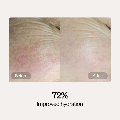 Image 1, before and after, 72% improved hydration. image 2, before and after, 63% improved firmness. image 3, before and after 21% reduced redness. image 4, before and after 24% improved elasticity.